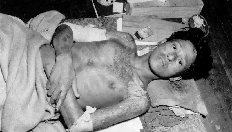 Nagasaki'den Gelen Uyarı: Nükleer Tehdit Yeniden Kapıda!