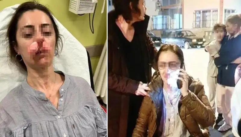 Araç Kapısı Silah Oldu: Eşinin Sevgilisiyle İletişimi Kesmek İstedi!