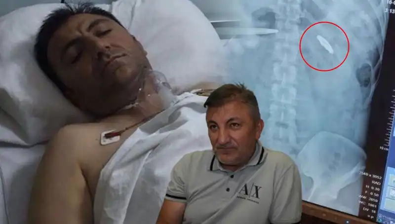 15 Temmuz’un İzleri: Vücutta Taşınan Kurşun ile 9 Yıl